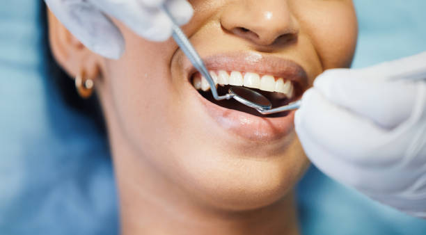 Best Emergency Dentist for Knocked-Out Tooth in West Pleasant View, CO